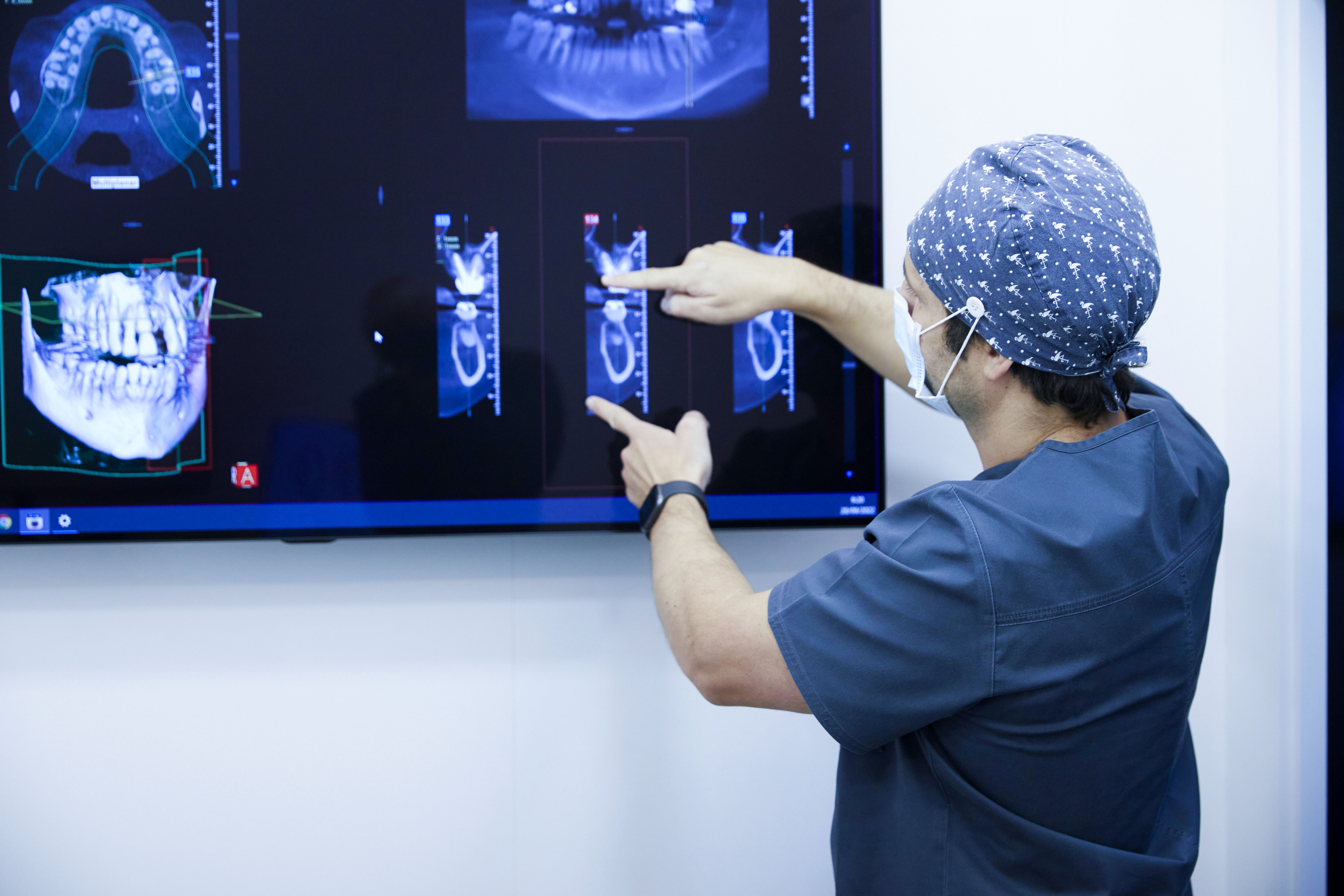 _H2A9245 Todo sobre los implantes All-on-Four