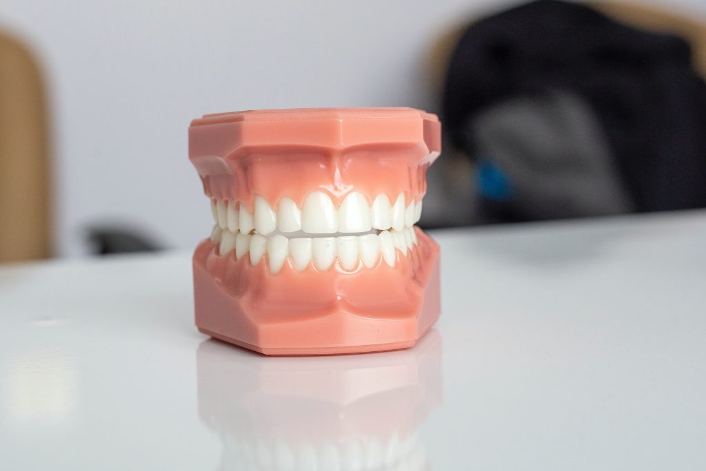 tratamiento periodontal Cuando la mejor opción es un tratamiento periodontal