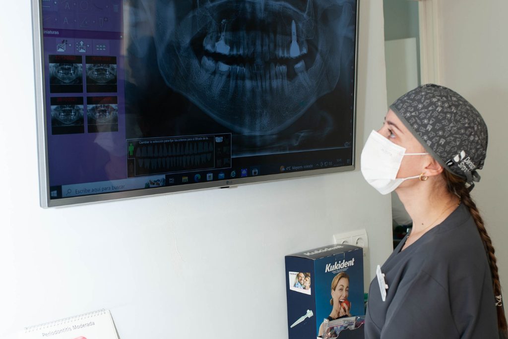 zirconio Ortodoncia estética de zirconio