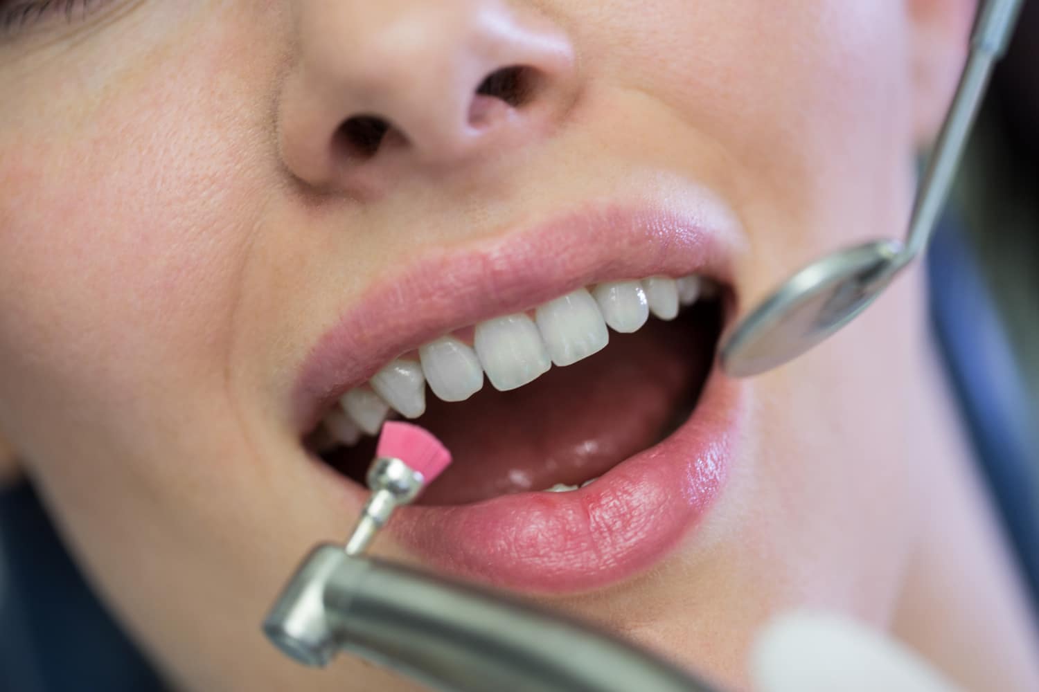 dentista-examinando-paciente-herramientas ¿Qué es la Periodontitis? : Un Enemigo Silencioso de la Salud Bucal
