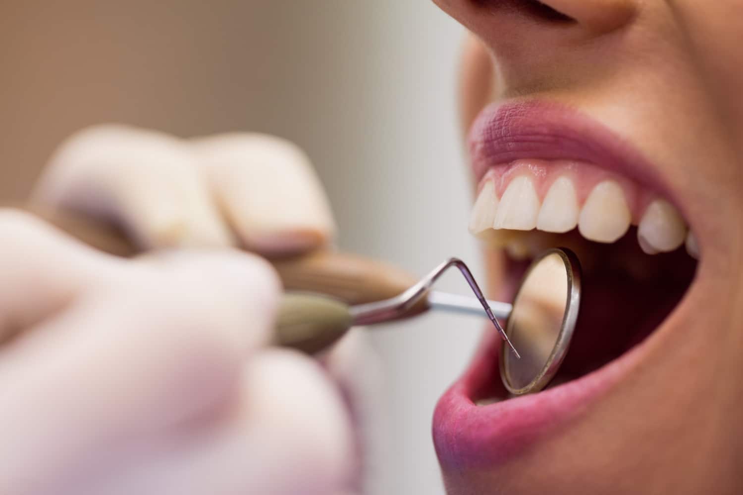 65429 La Higiene Oral en la Longevidad de los Implantes Dentales