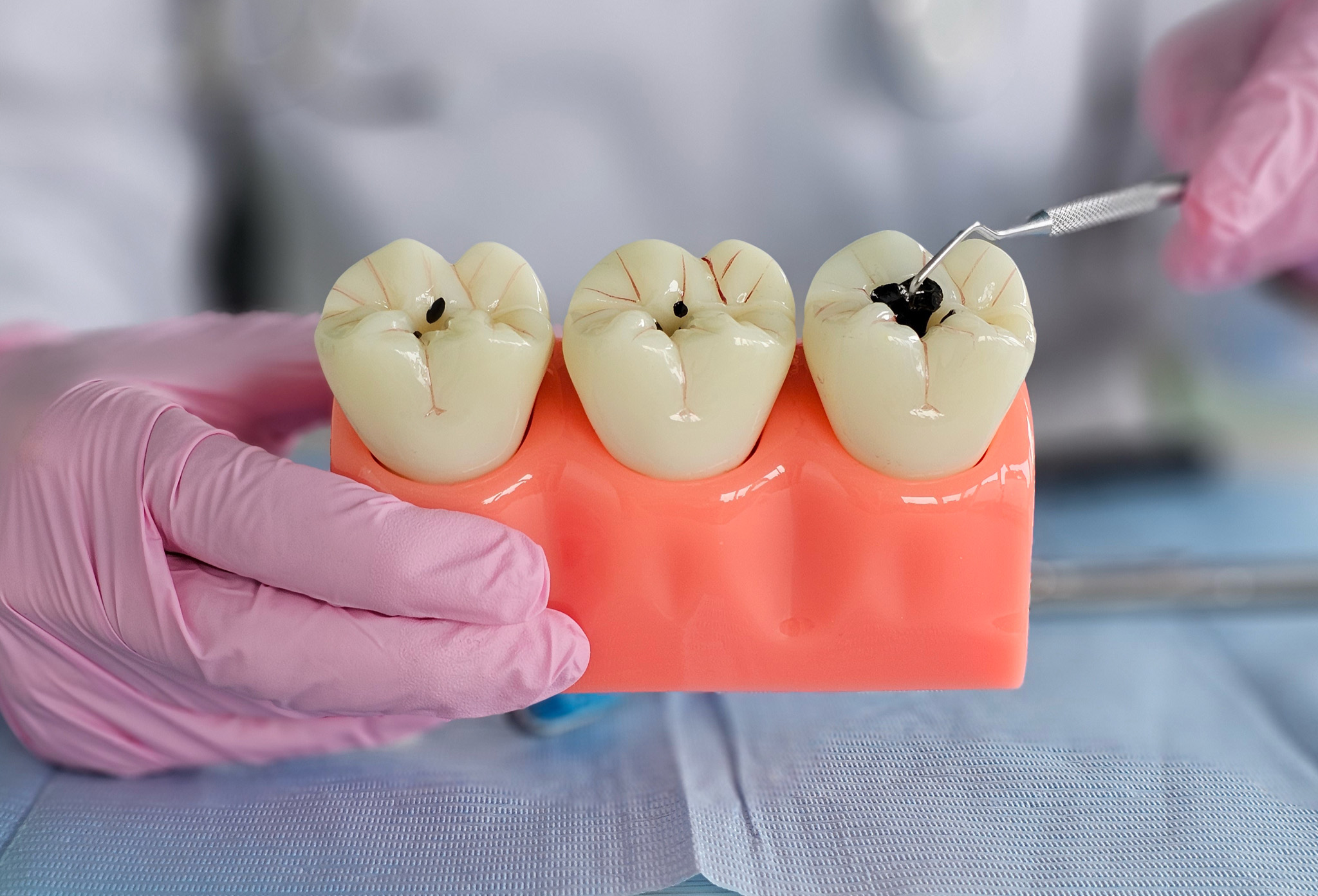 endodoncia_1 endodoncia_1