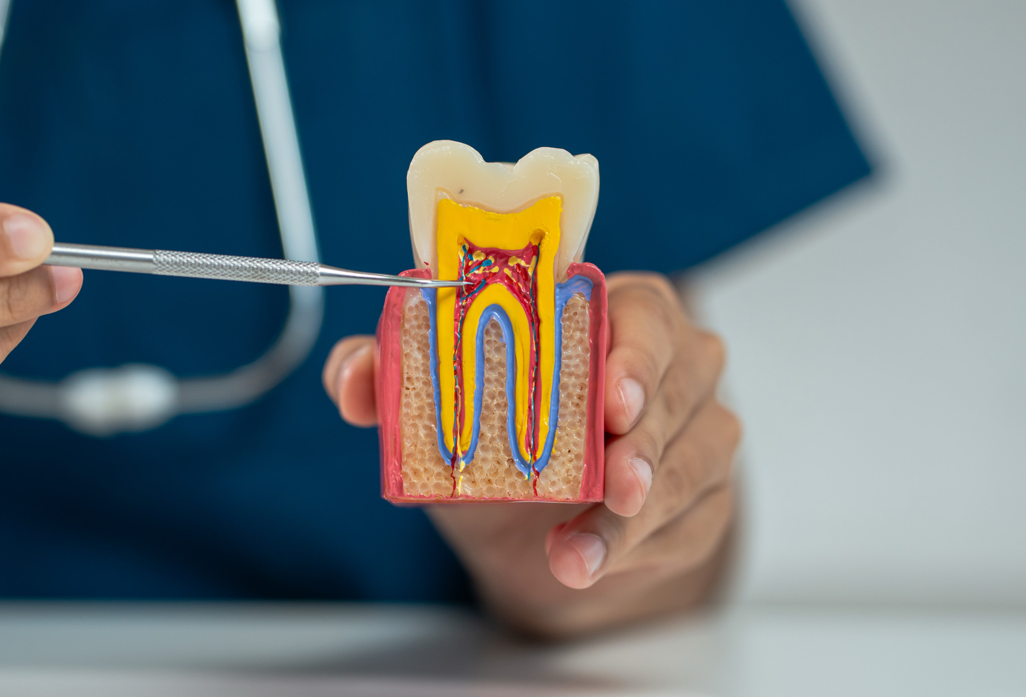 endodoncia_4 endodoncia_4