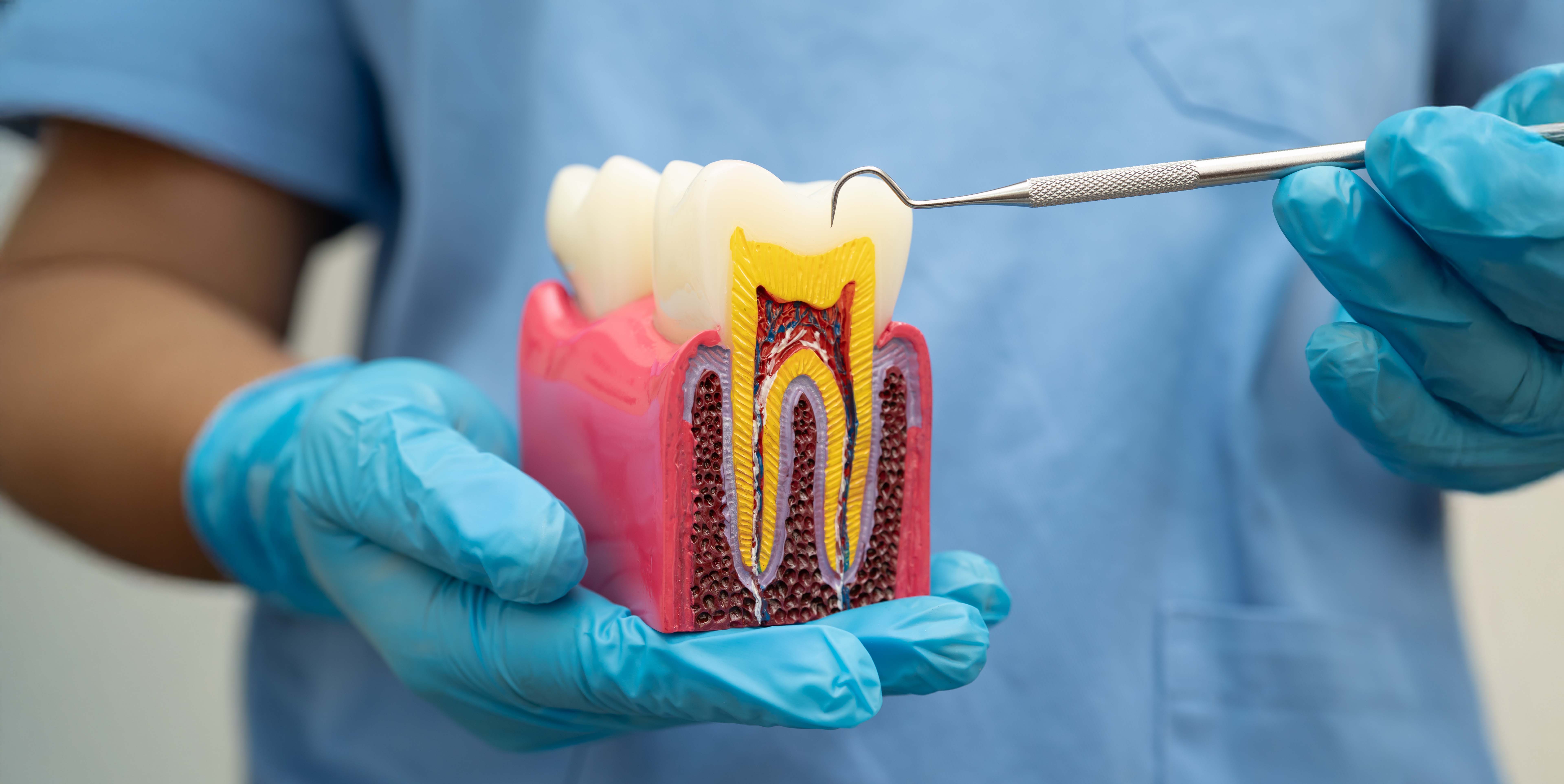 ENDODONCIA ENDODONCIA