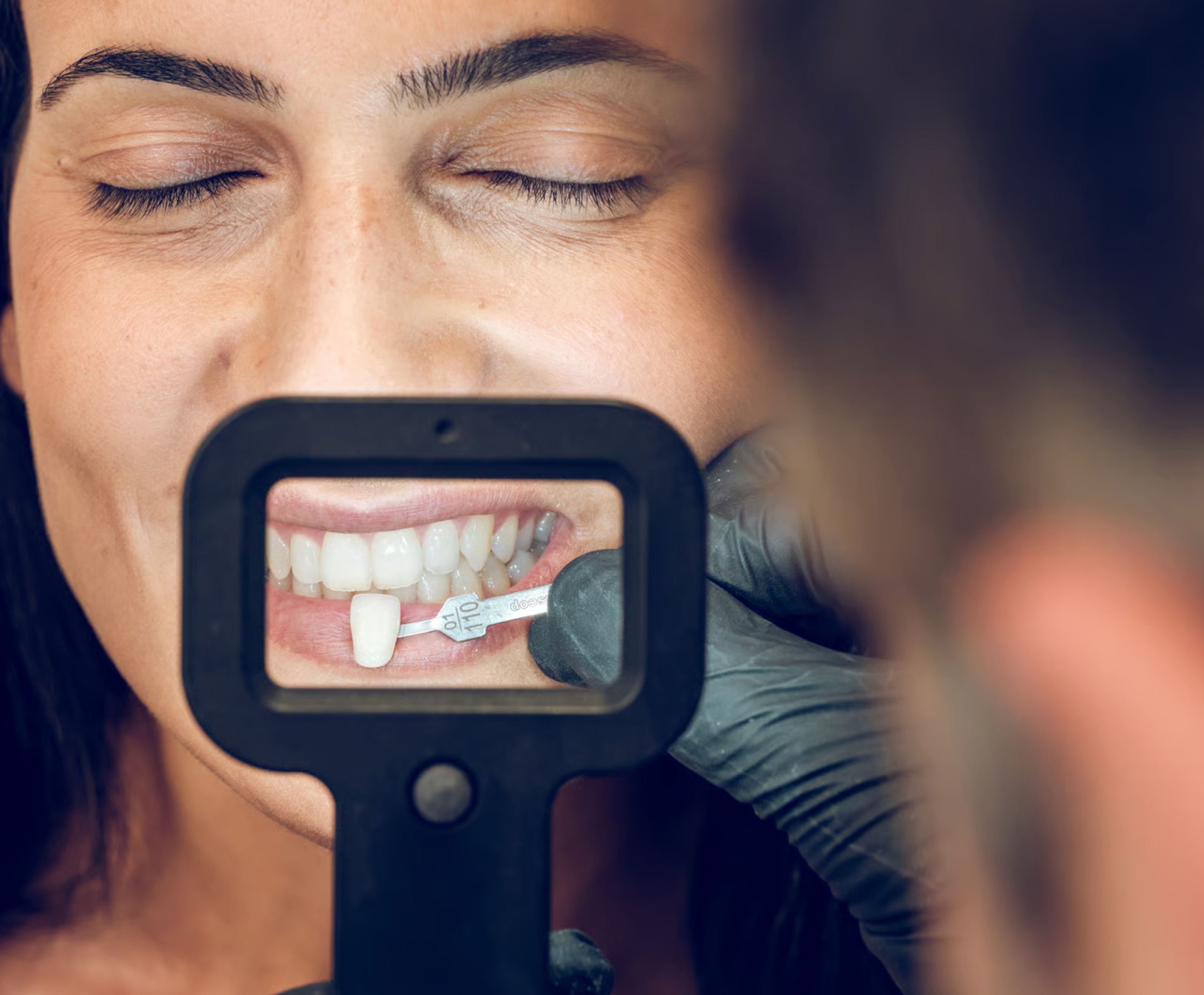 ESTETICA DENTAL ESTETICA DENTAL