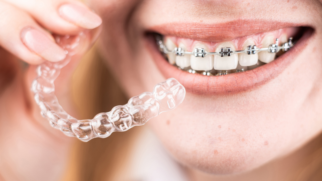 Dental care.Smiling girl with braces on her teeth holds aligners in her hands and shows the difference between them Dental care.Smiling girl with braces on her teeth holds aligners in her hands and shows the difference between them