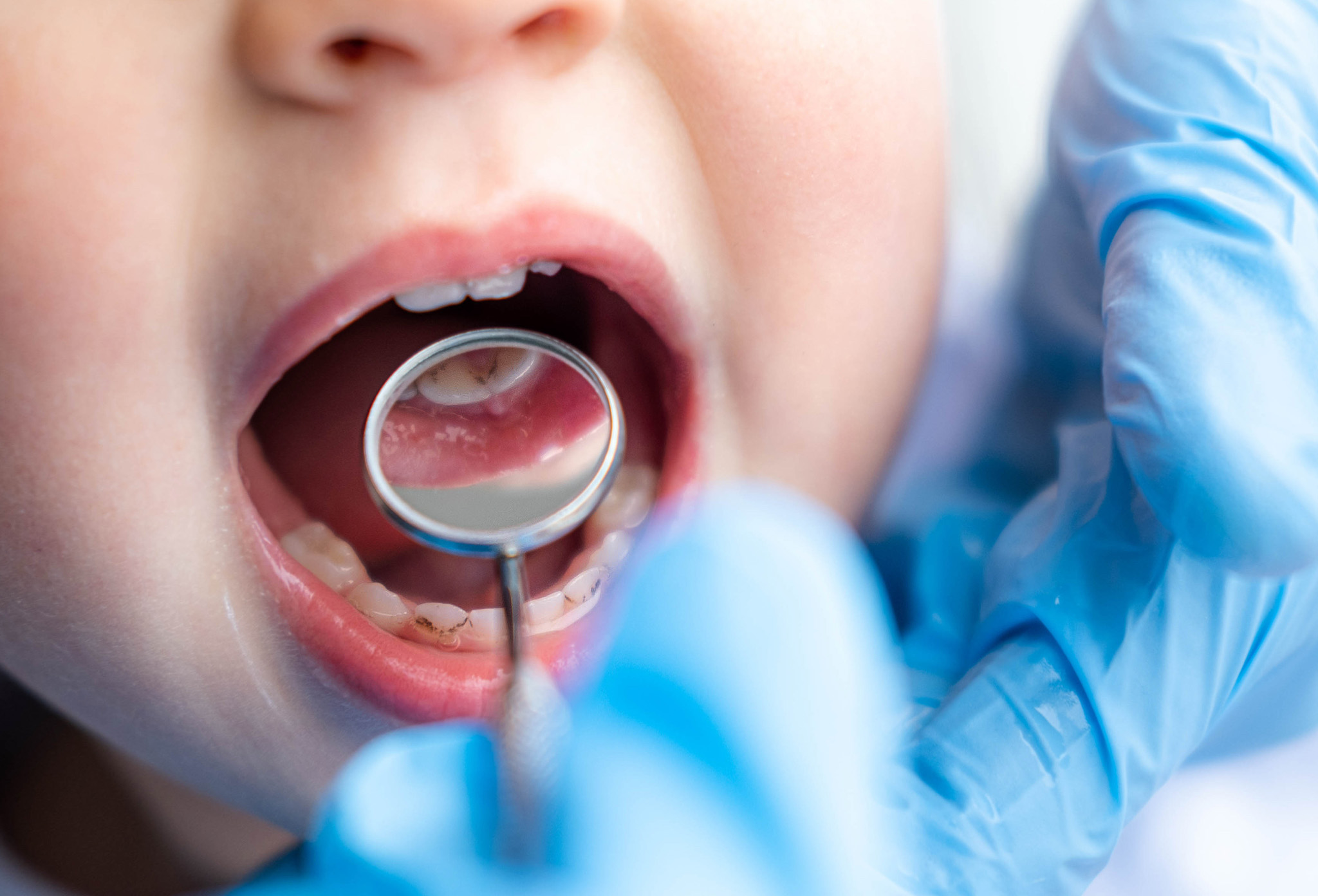 otros_tratamientos_odonto_pediatria_2 otros_tratamientos_odonto_pediatria_2
