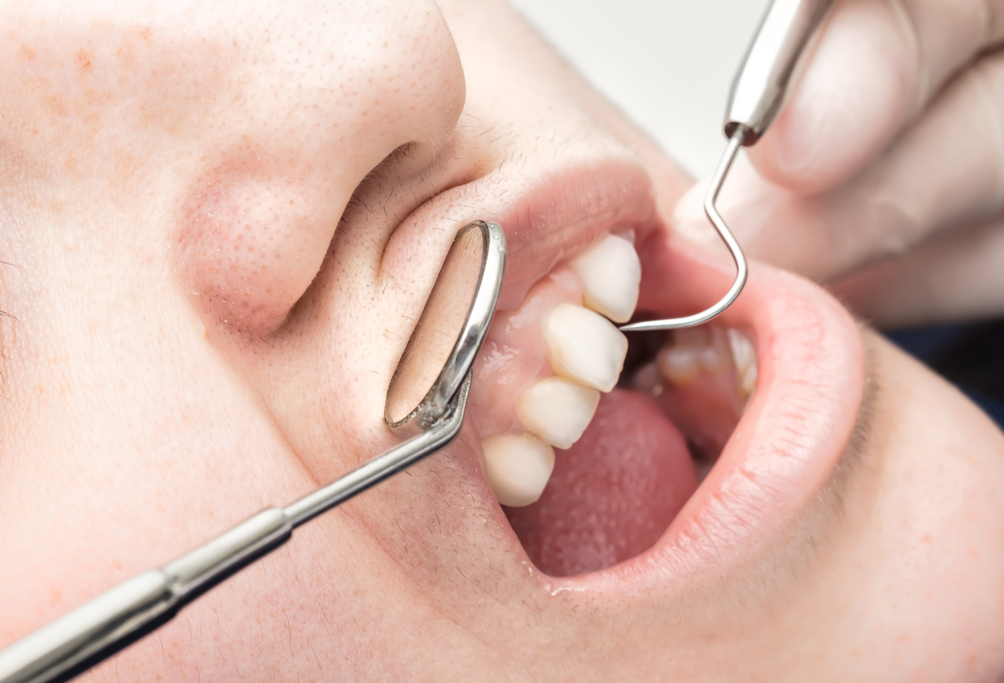 otros_tratamientos_periodoncia_ otros_tratamientos_periodoncia_