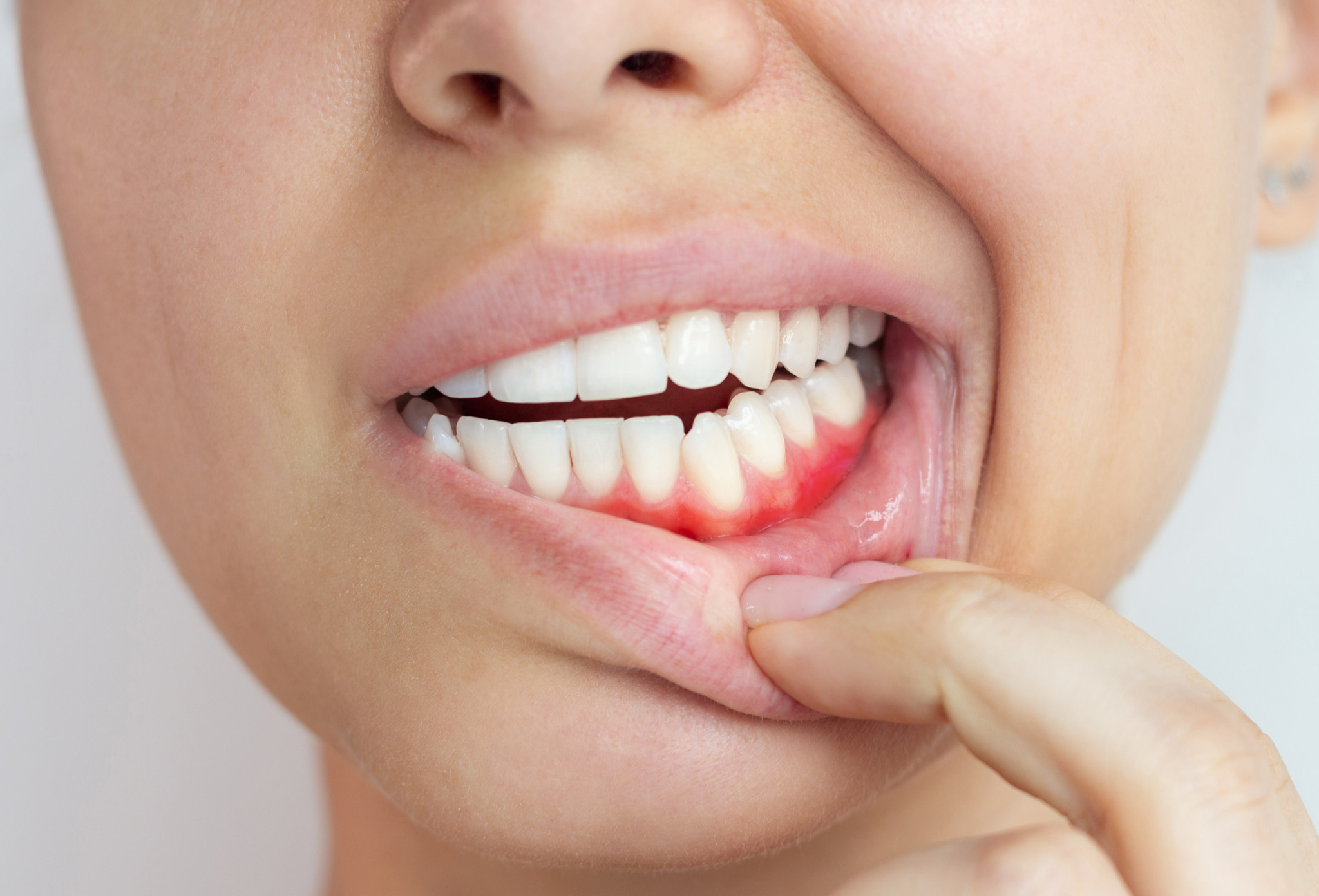 otros_tratamientos_periodoncia otros_tratamientos_periodoncia