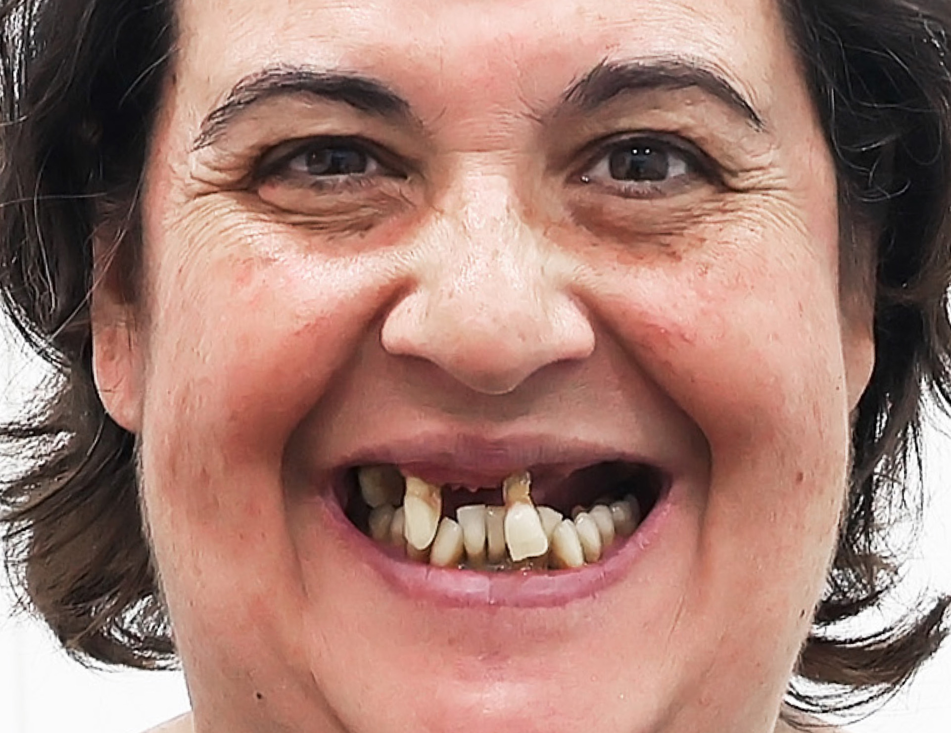 Antes
