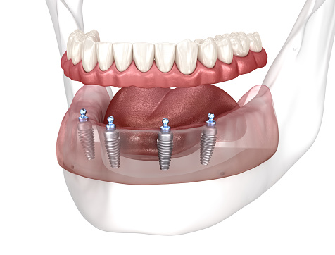 istockphoto-1370426602-170667a istockphoto-1370426602-170667a